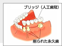 ブリッジイメージ