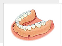 入れ歯イメージ2
